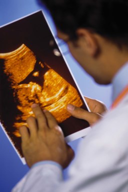 Doctor examining ultrasound scans.